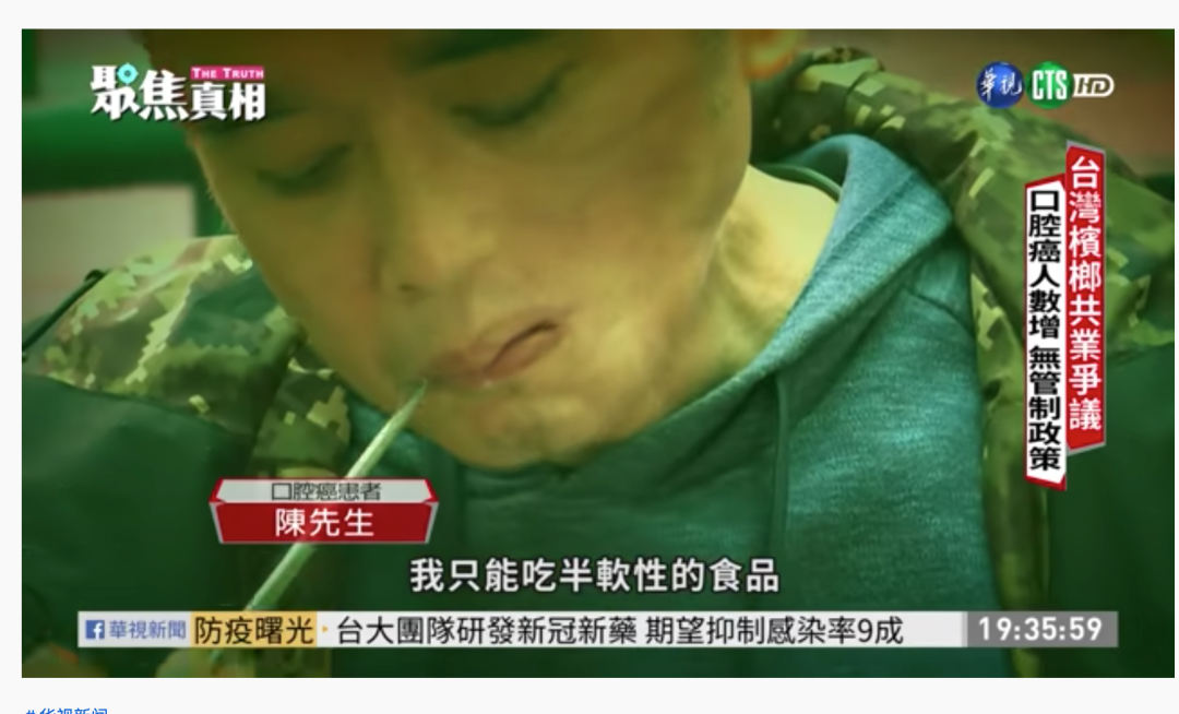 槟榔,口腔癌,口腔,癌症,实习,肿瘤,口腔科