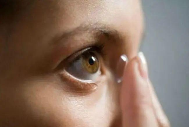 眼睛长 痘痘 红肿又疼痛 麦粒肿 怪我怪我 天天要闻