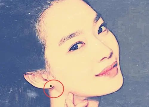 Is A Mole On The Earlobe Good Or Bad Is A Mole On The Tip Of The Female Nose Good Affect The Fate Of Marriage Daydaynews