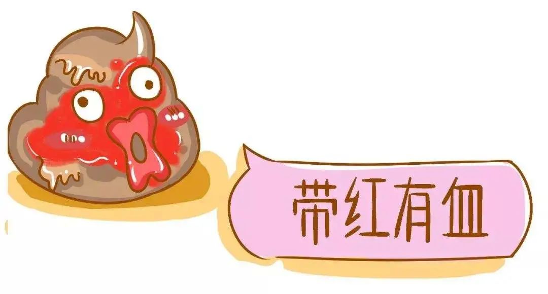 便血,大便出血,肛门,溃疡性结肠炎,消化道出血,排便,直肠