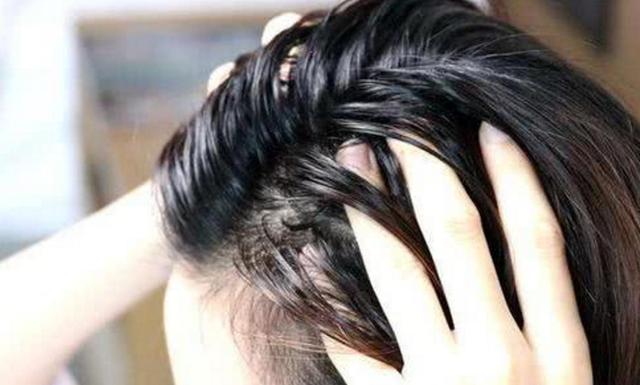 Hair is always oily and smells oily! Learn these 2 tricks to get rid of the embarrassment of greasy scalp