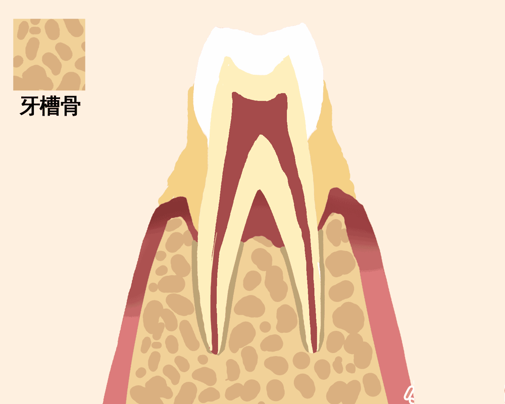 种植牙,牙齿,svenjohansson,牙齿种植,患者