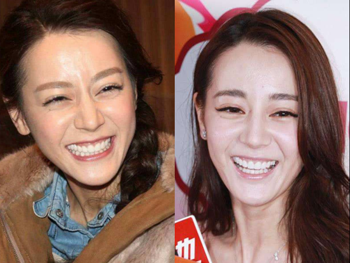 女星开怀大笑时:赵丽颖可爱,杨颖夸张,看到最后瞬间被