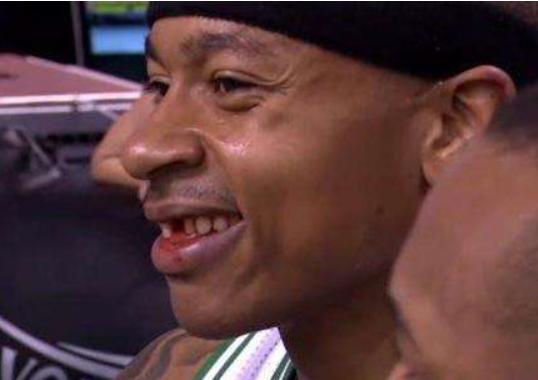 NBA賽場戴牙套有何用？柯瑞除了保護牙齒，竟還有這些功能！-黑特籃球-NBA新聞影音圖片分享社區