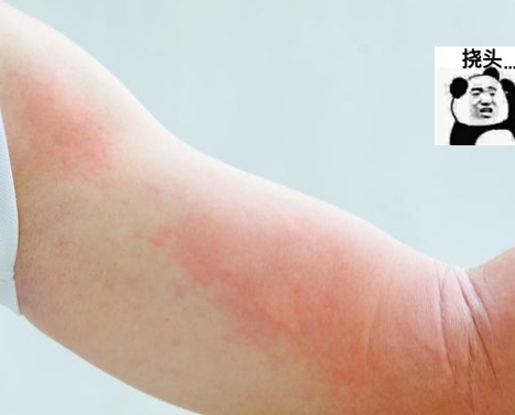 冬季来了 皮肤瘙痒怎么办 皮肤科大夫喊话注意这几个细节 看点快报