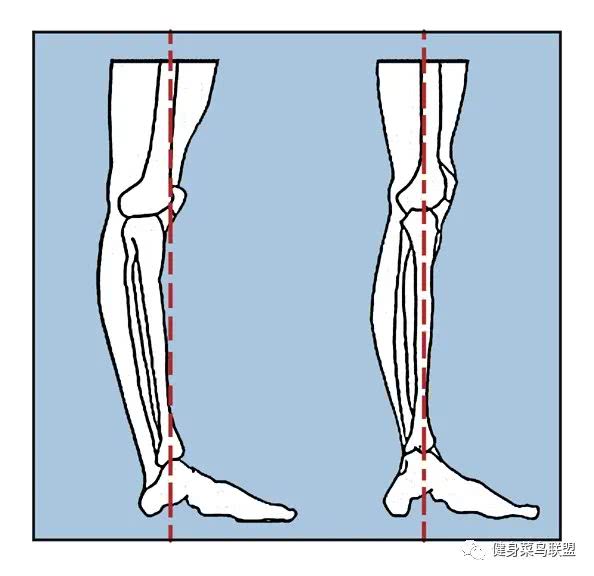 小心膝过伸,很多人不曾留意的重要细节!