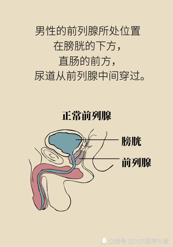前列腺,前列腺肥大,前列腺增生