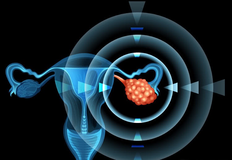 36岁的她肚子越来越大 误以为怀孕 结果是 女性杀手 找上门 看点快报