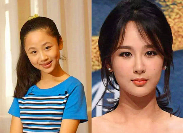 杨紫被整容医院当宣传照,肆无忌惮,仅眼睛被贴胶布条