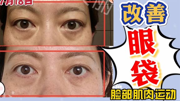 0?fmt=jpg&size=43&h=324&w=576&ppv=1