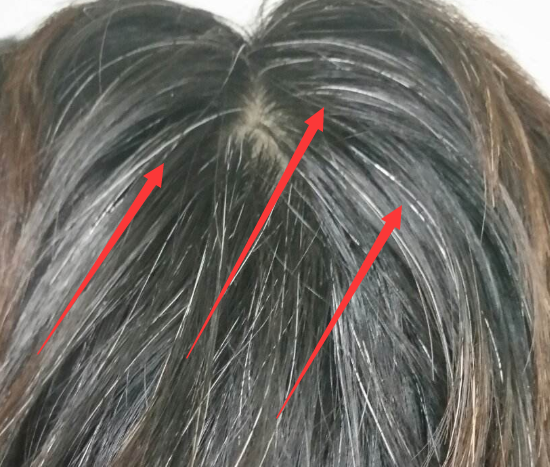 为什么白头发不能拔,拔一根长十根?