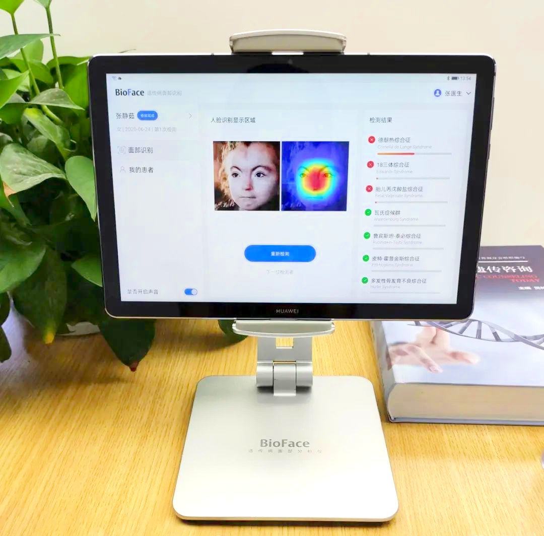 [Heavyweight] The disease facial recognition system won the