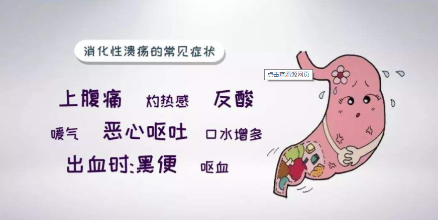 典型症状: 消化性溃疡的典型性表现是周期性的上腹痛或者不适,一般在