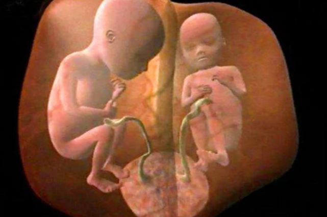 女性每月排一颗 卵子 如何生双胞胎 做好4点 或许可 一箭双雕 看点快报