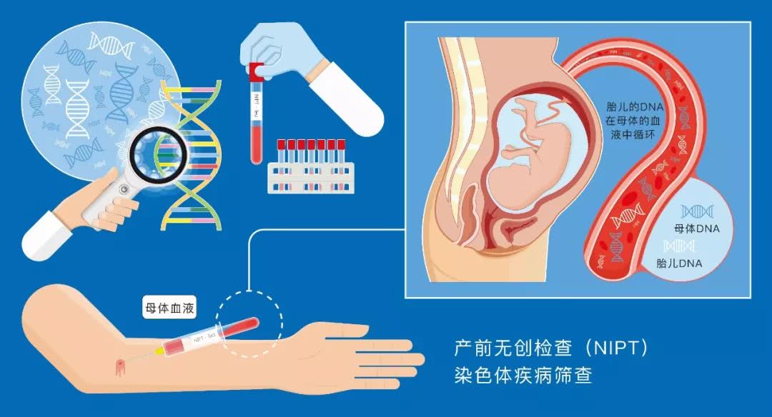 有了无创dna产前检测 那些穿刺检查就不用做了 读完这篇文章你就明白了 看点快报