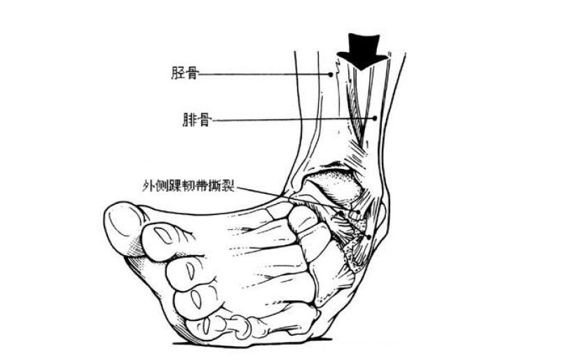 踝关节