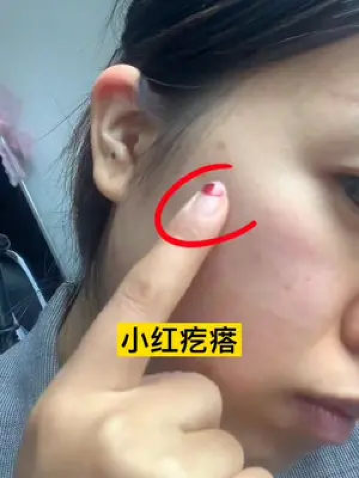 梦境交织，从鼻孔脏物到闹分手的深层解析