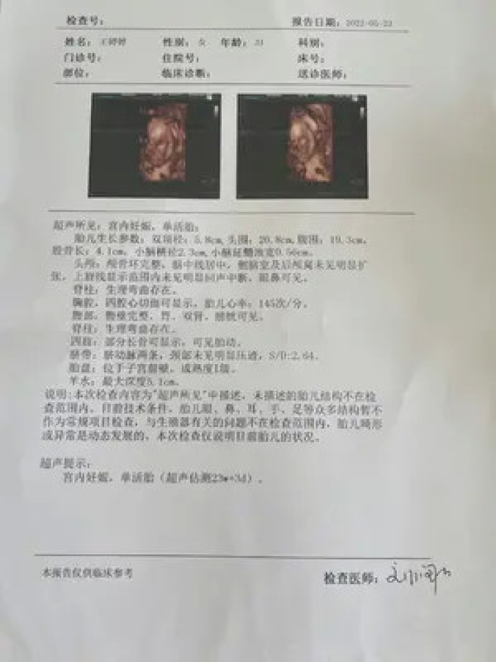 梦境中的孕育与成长，解析梦见自己怀孕一次孕检都没做过，超过10天还未生产的预兆