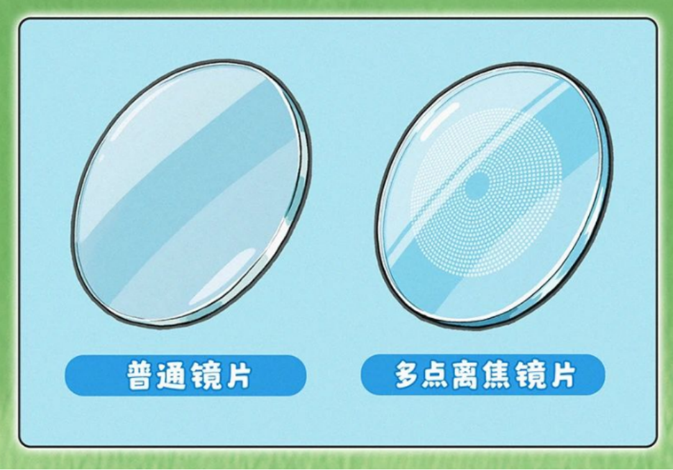 低度近视防控攻略：普通镜、离焦镜、ok镜到底怎么选？