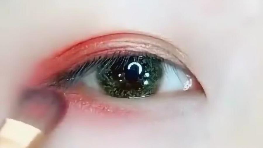 眼睛超级会晕怎么办，眼睛超级痒怎么办