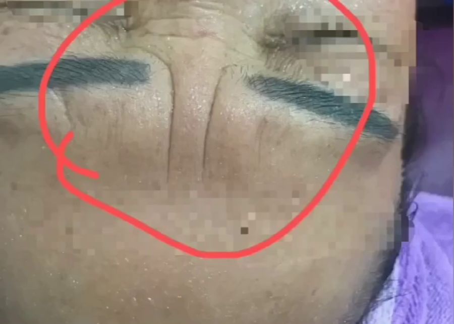 0