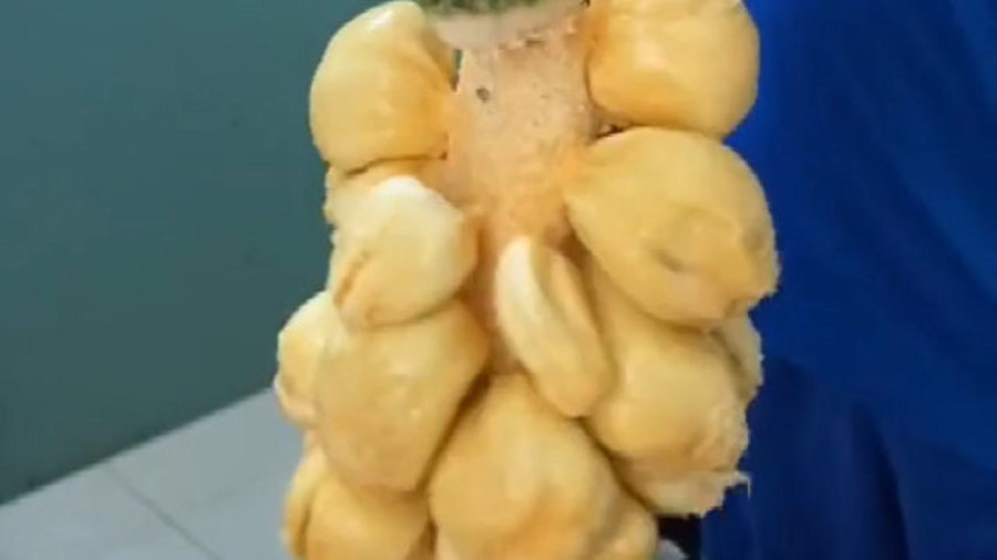 0