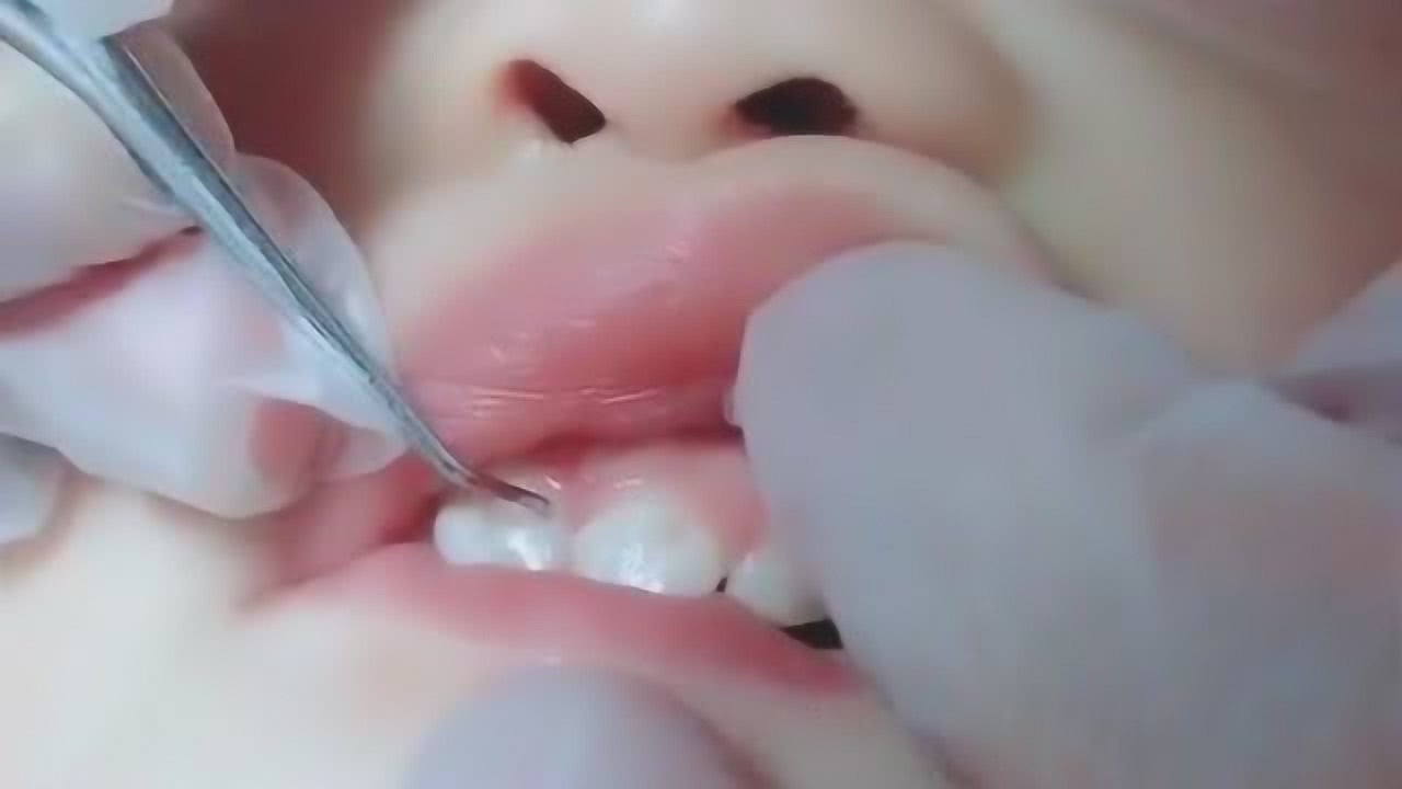 反复梦见牙齿碎了掉出来，梦境背后的深层解析与心理启示