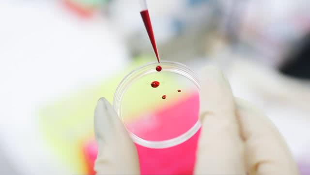 科学家发现了珍贵的黄金血液,全球仅43人,拥有者已救治多人