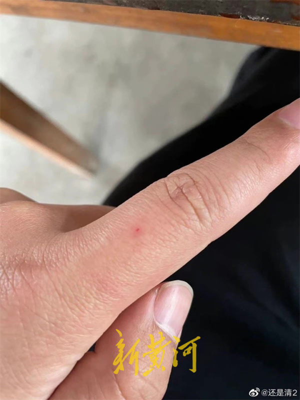 网购新衣内含针头扎伤消费者，迪卡侬郑重道歉并开除发表不当言论的客服