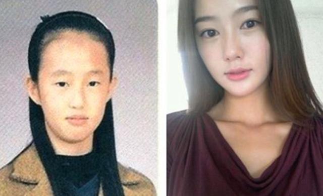 实拍 6名韩国女子整容前后照片曝光 整容后如同换了一张脸