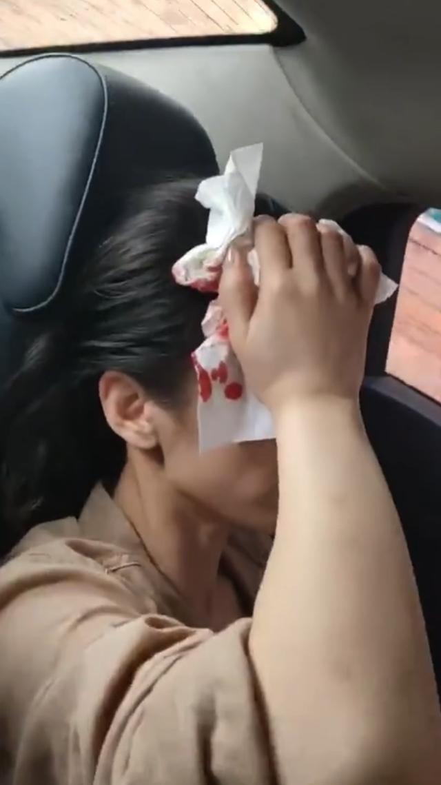 网曝黄圣依被道具砸头血流不止,纸巾捂头强忍疼痛恐破相