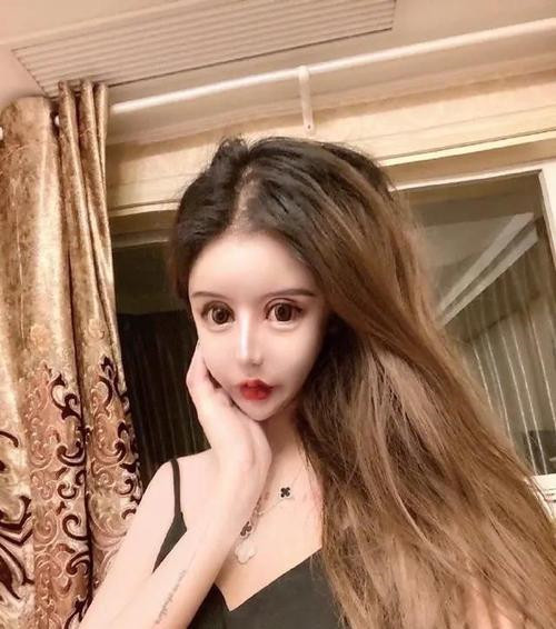 女孩13岁开始沉迷整容,3年时间共计整了60次,如今已经"面目全非"