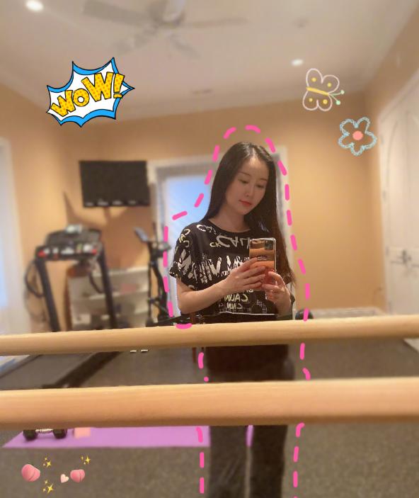 舒畅罕晒近照,两年未拍戏脸部发福明显,发际线上移略有秃头趋势