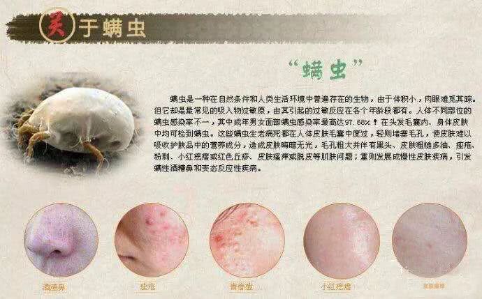 洗衣粉,螨虫