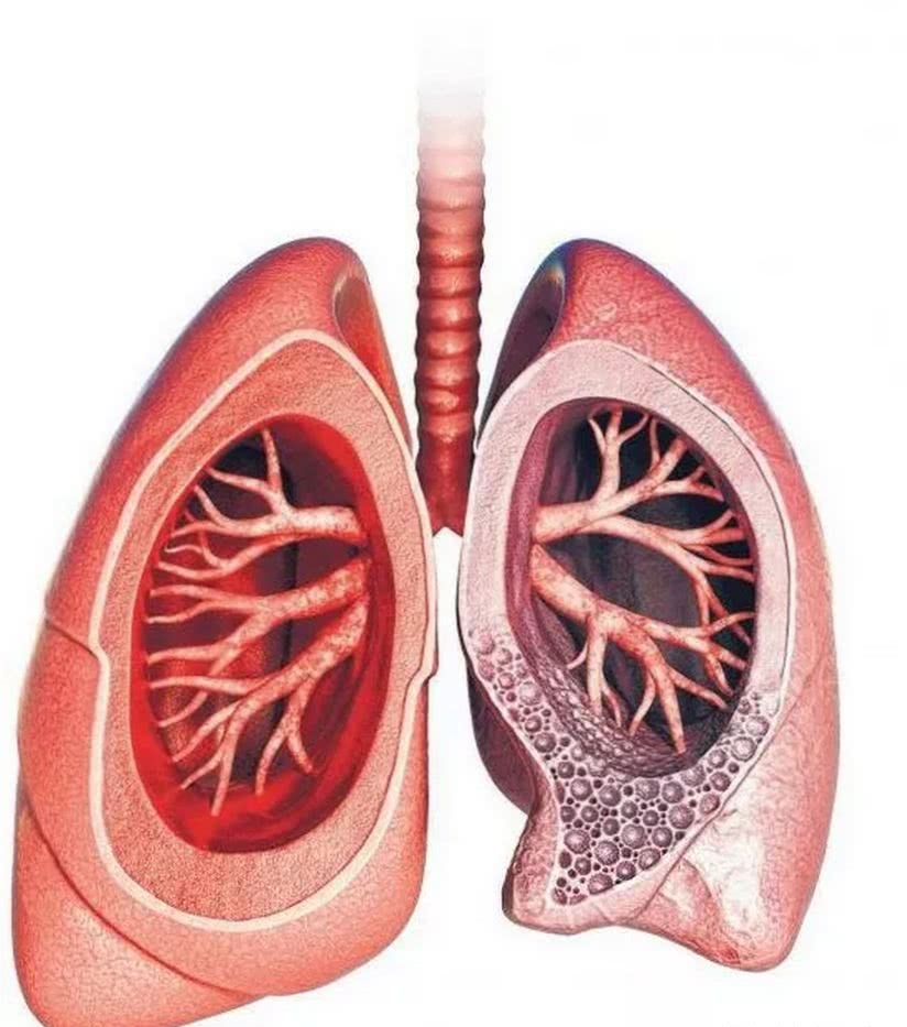 重症才有危险,与球员抵抗力无关