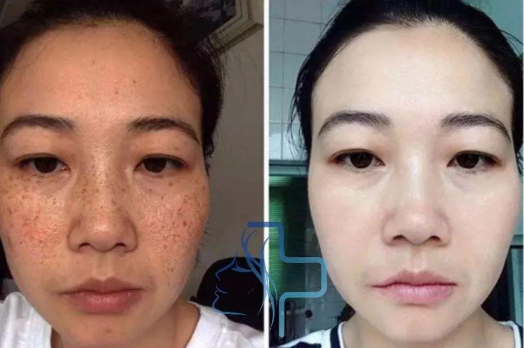 90后小伙在菏泽出名了!把鲜花当面膜敷,皮肤白嫩得让女生羡慕!