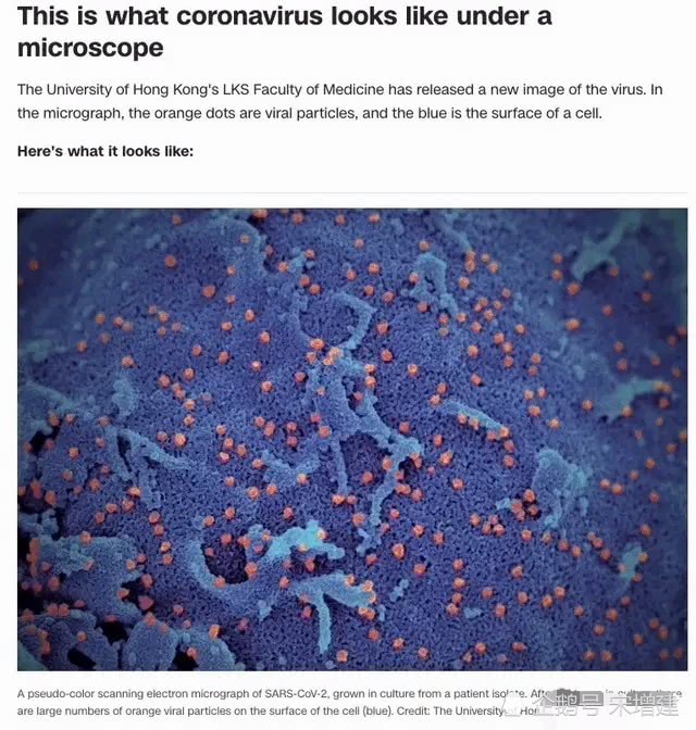 一大群新冠肺炎病毒,从细胞中钻出来的样子