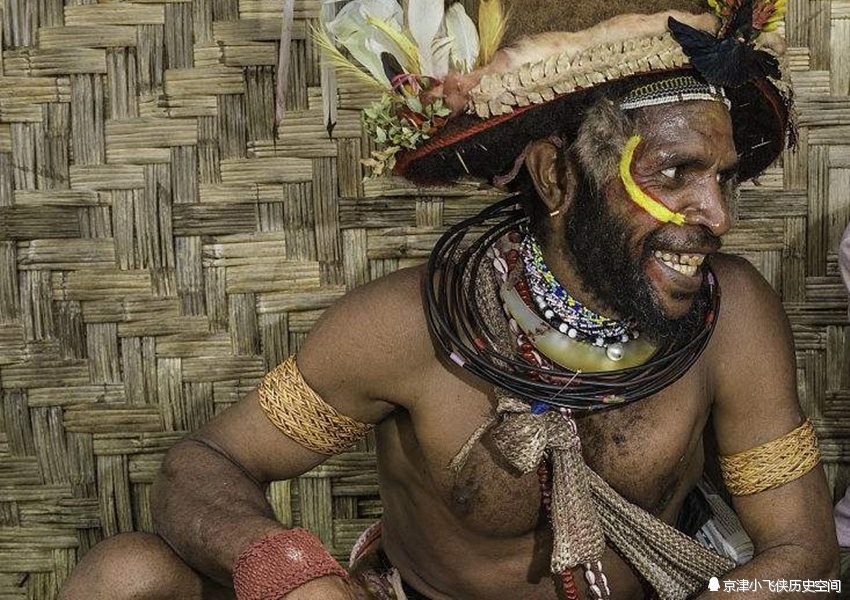 世界五大怪病 一种大笑而死 一种哭如猫叫 一种生来像条美人鱼