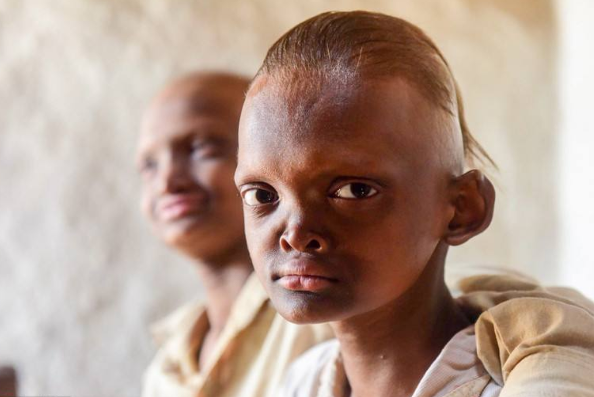 中学时期这3类学生基本没有早恋的机会,家长不用担心影响学习!