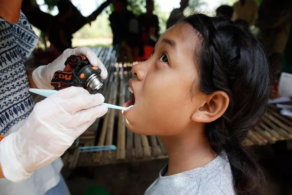 柳叶刀:高糖摄入及全球忽视加剧口腔卫生危机