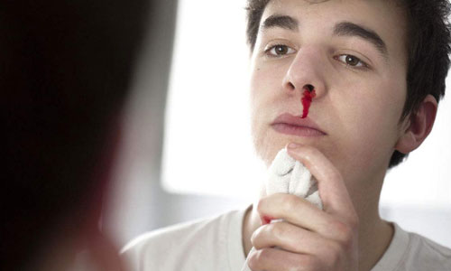 气候干燥引发流鼻血?简单4招快速止血!