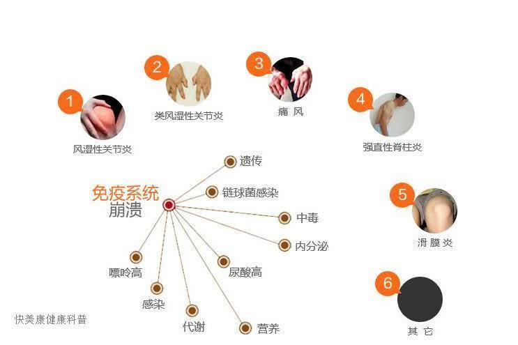 引起免疫系统疾病的因素有哪些,快美康健康小知识!
