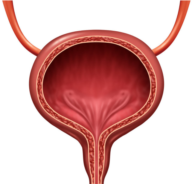 悬挂在"天花板"上的结石,一例特殊的膀胱结石,聊聊膀胱结石