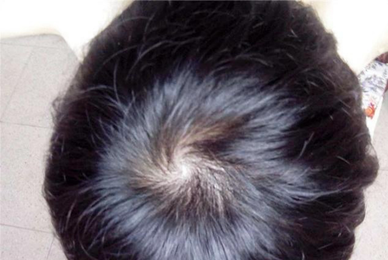 孩子头顶有两个旋到底代表啥看完你就明白了