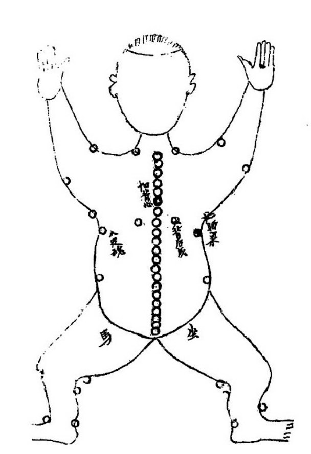 [转载]慈心觉者：隐光回生手术歌诀：二十四推【干货】