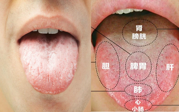 [转载]痰在哪、哪生病，化痰中药众多如何选？沈医生一次给你讲明白
