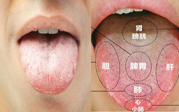 痰在哪、哪生病,化痰中药众多如何选?沈医生一次给你讲明白 痰在哪、哪生病,化痰中药众多如何选?沈医生一次给你讲明白