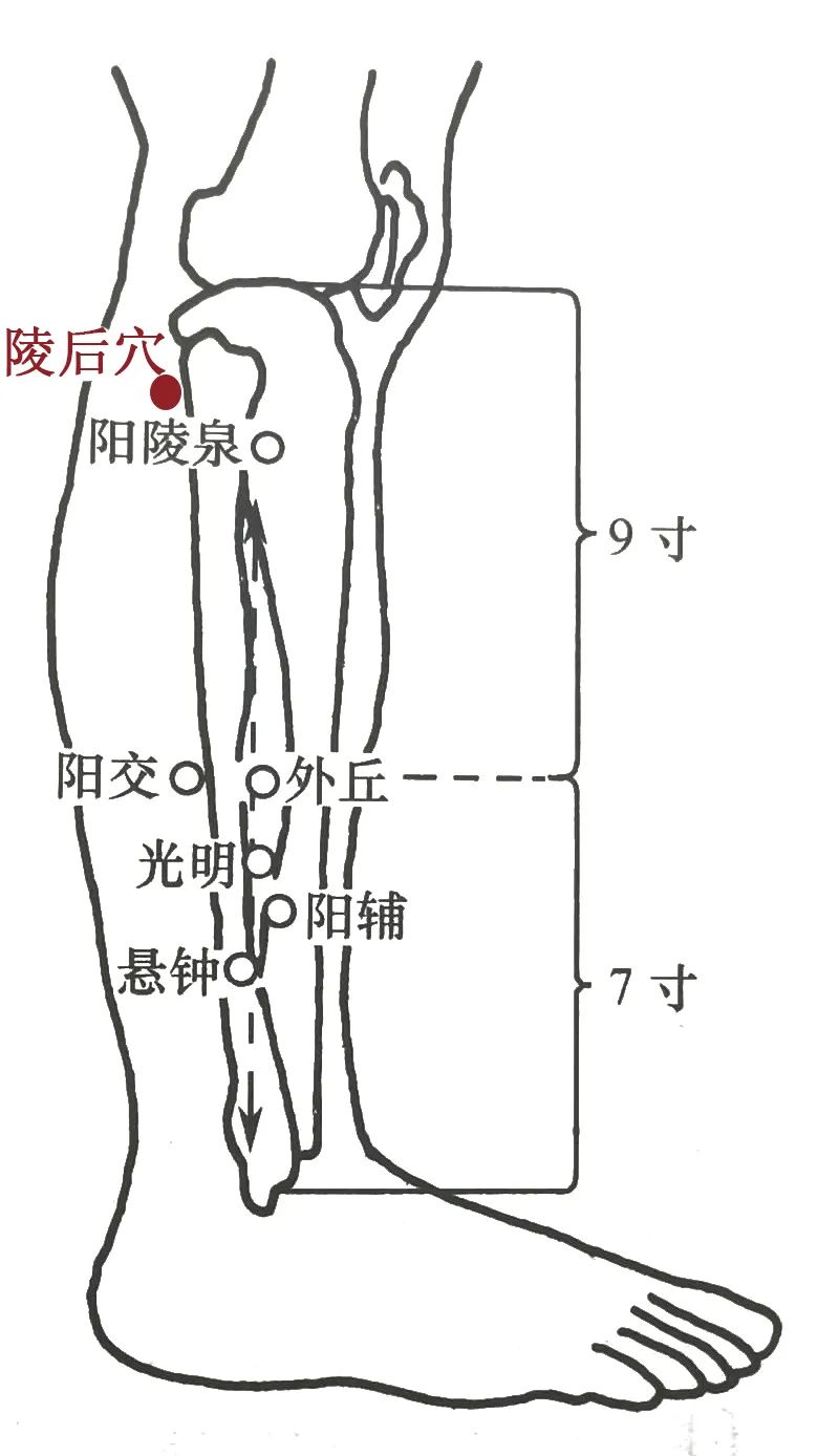 4种临床常见痛证的一针疗法